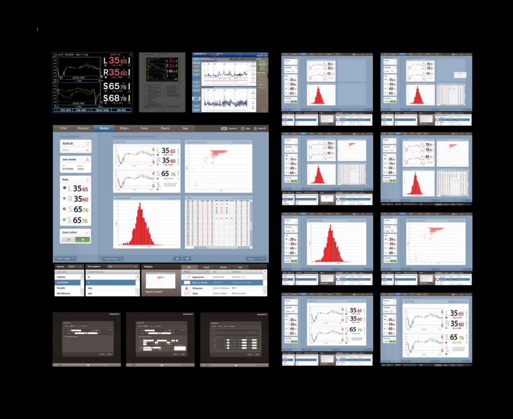 Romanetics — real-time anesthesia monitoring dashboard